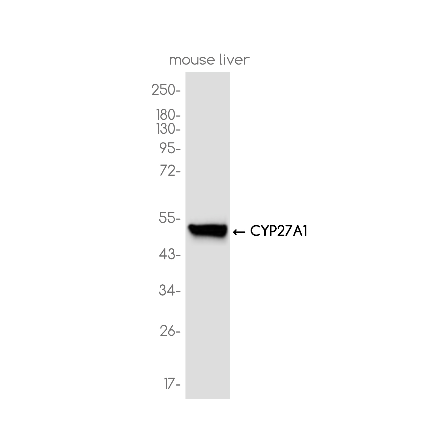 CYP27A1 Rabbit mAb ABZ3745