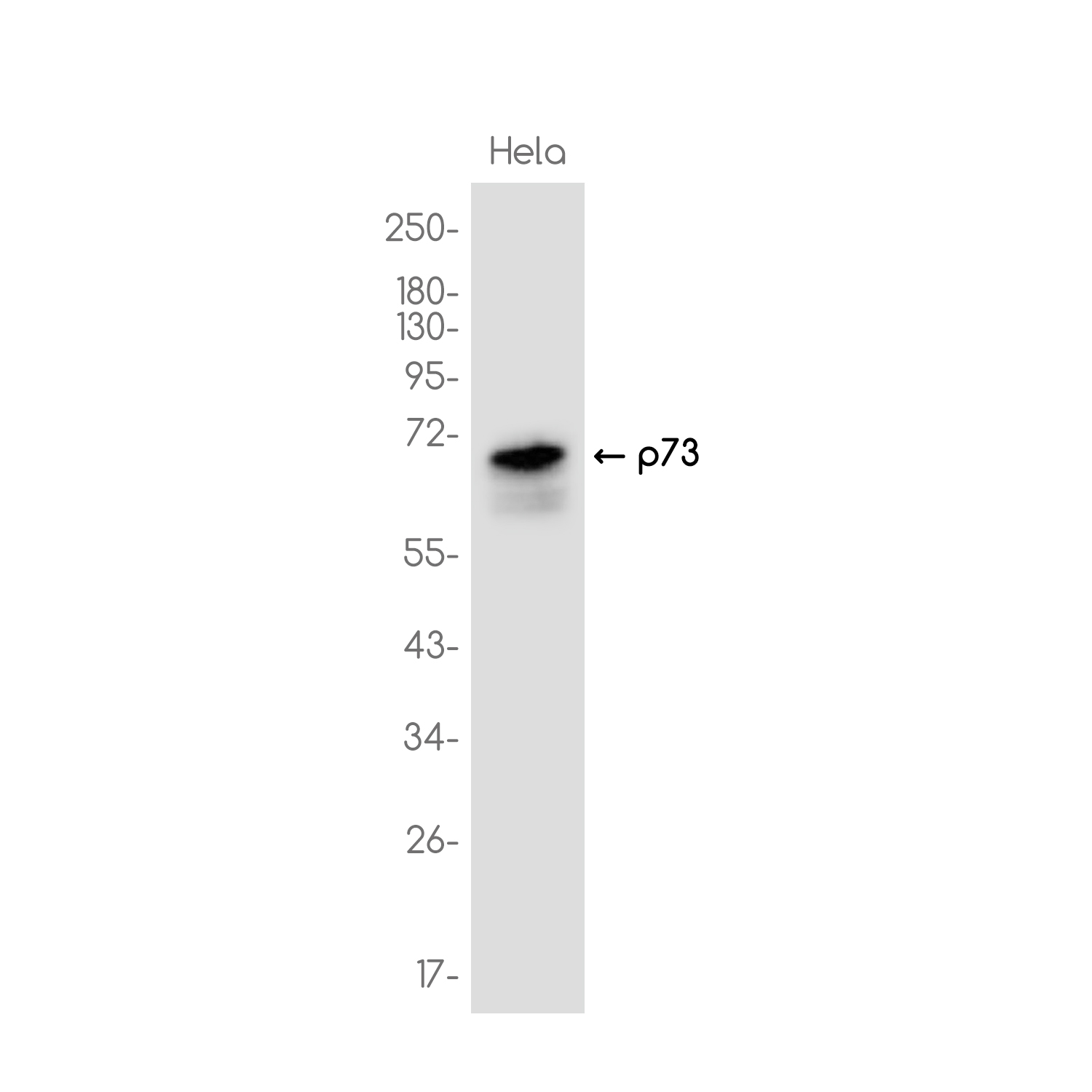 p73 Rabbit mAb ABZ3746