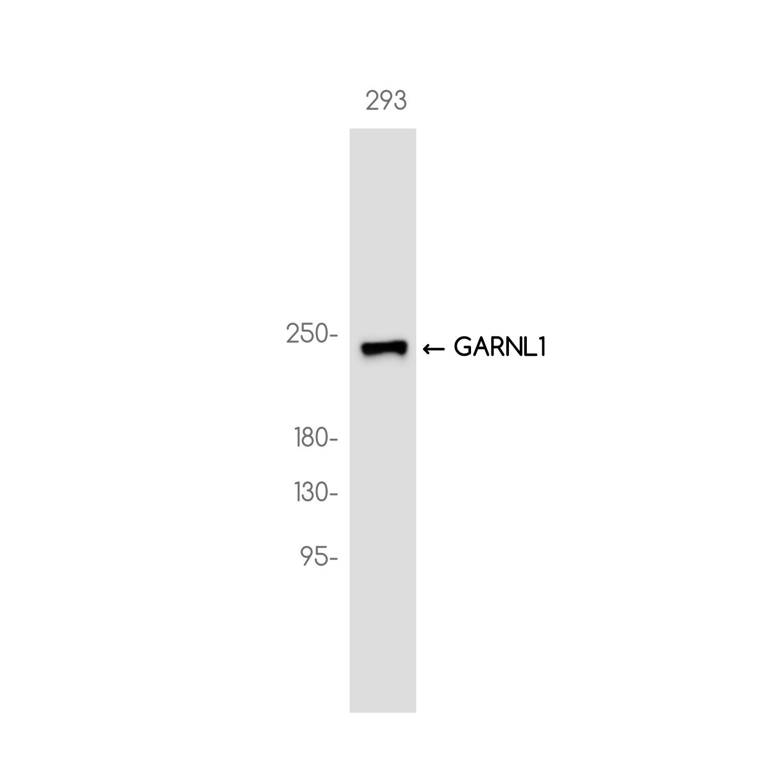 GARNL1 Rabbit mAb ABZ3747