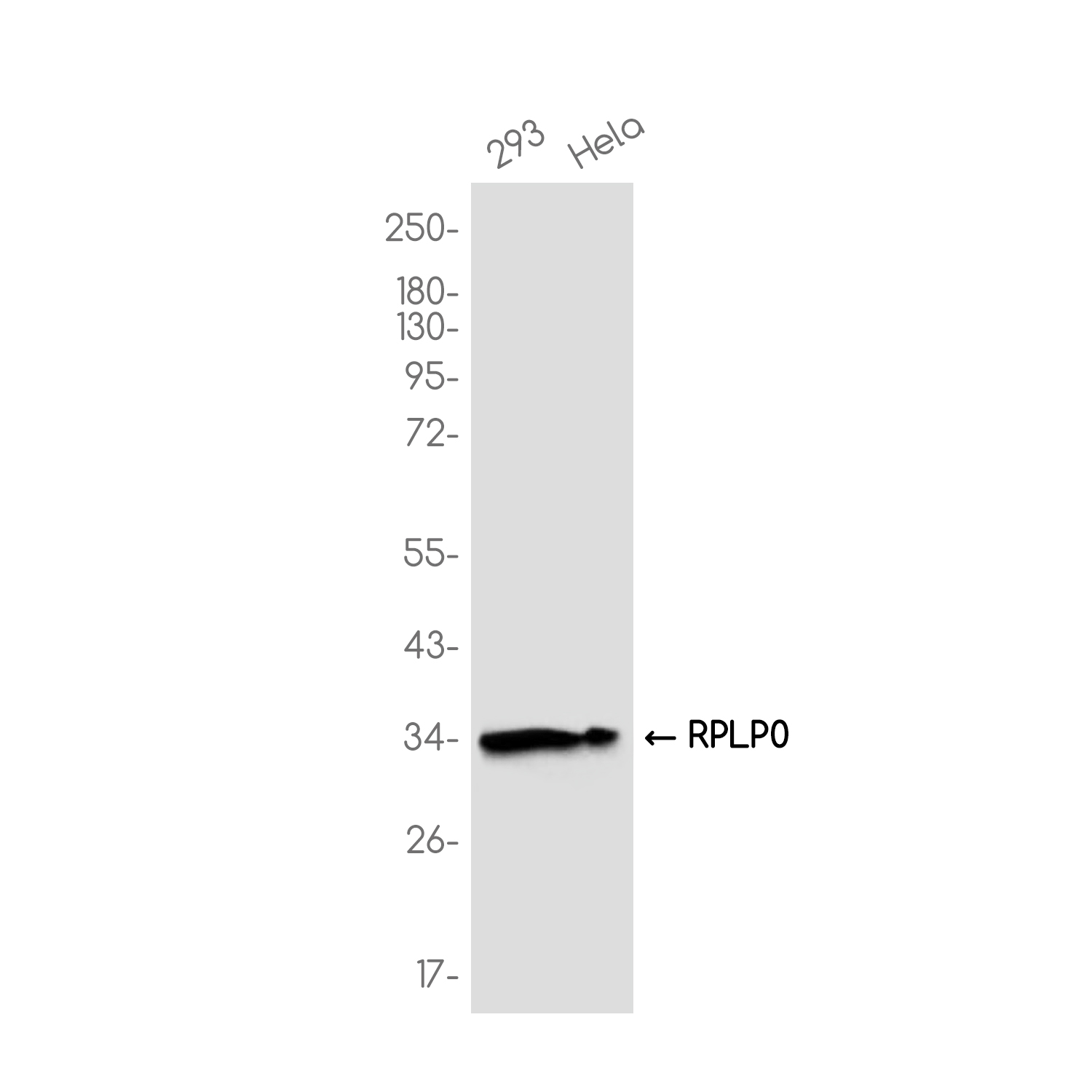 RPLP0 Rabbit mAb ABZ3748