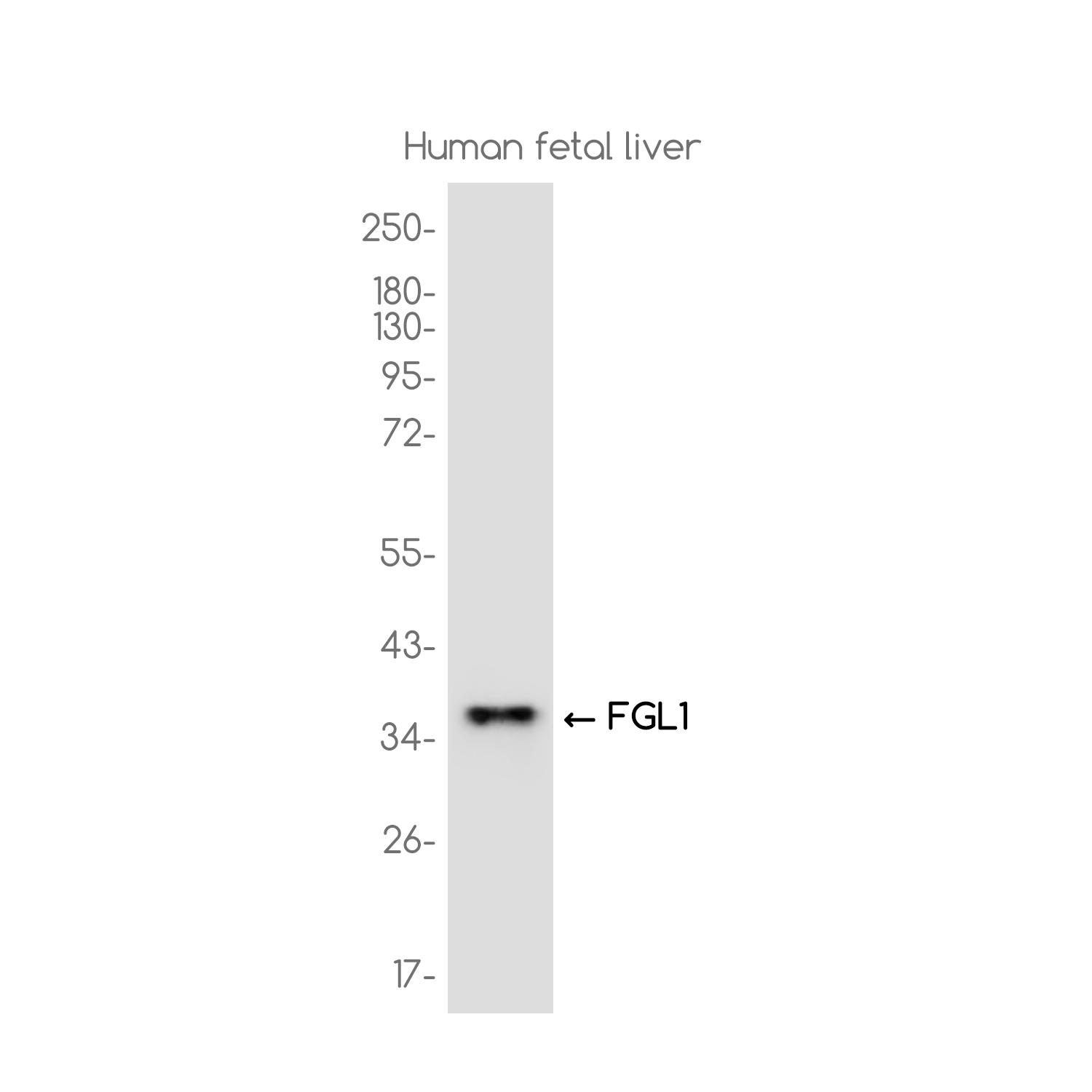 FGL1 Rabbit mAb ABZ3751