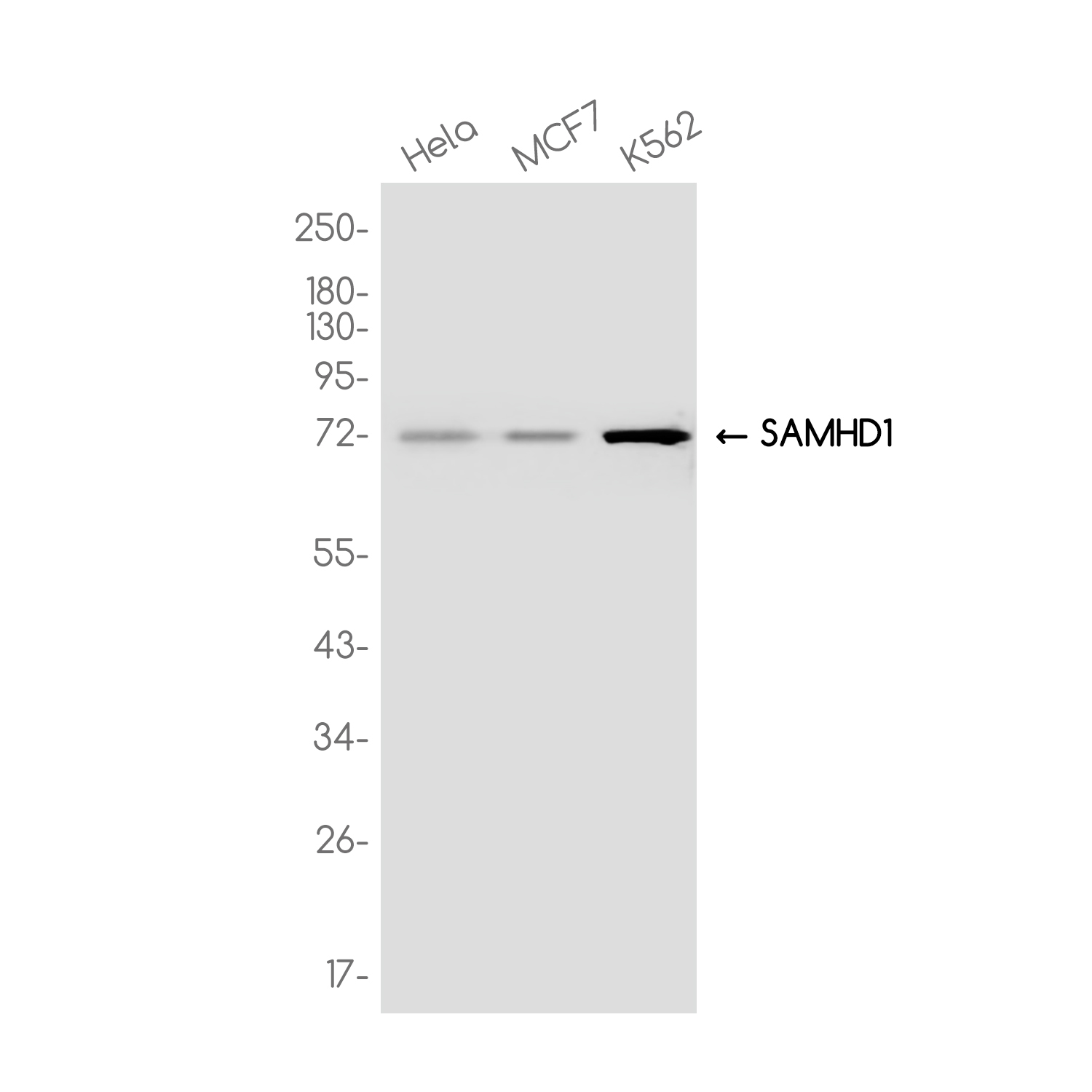SAMHD1 Rabbit mAb ABZ3752