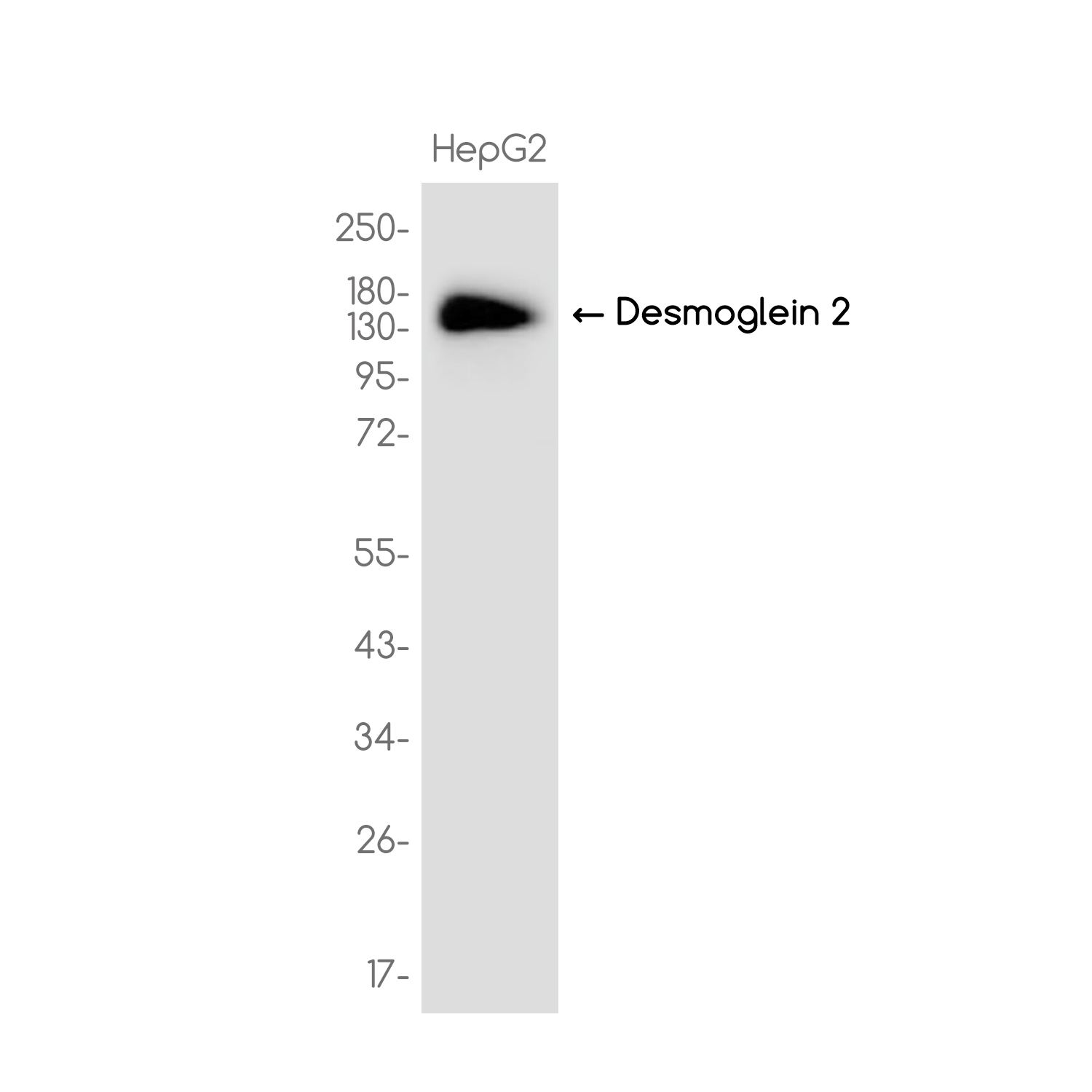 Desmoglein 2/DSG2 Rabbit mAb ABZ3753