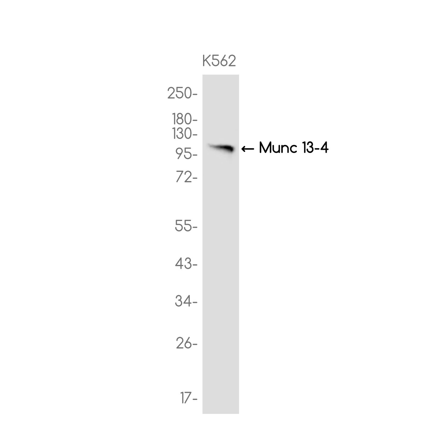 Munc 13-4 Rabbit mAb ABZ3756