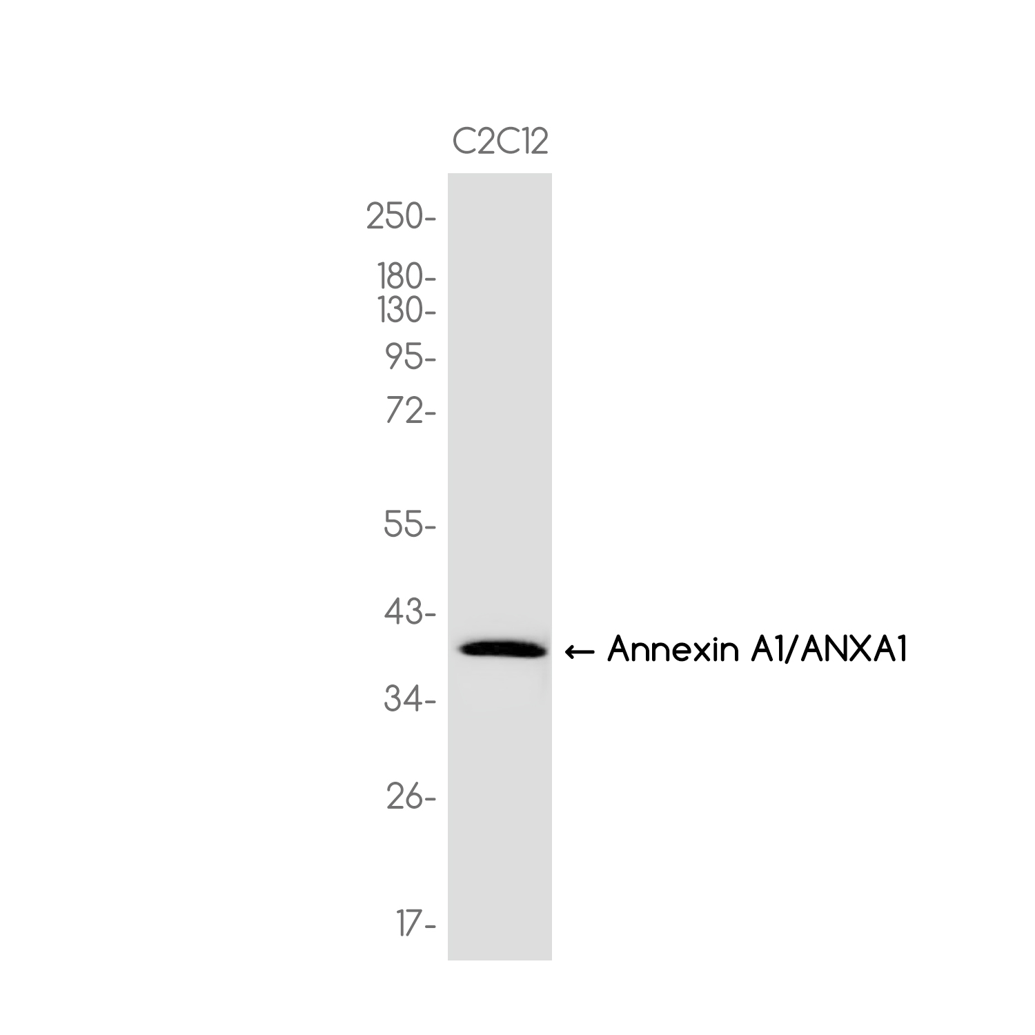 Annexin A1 Rabbit mAb ABZ3757