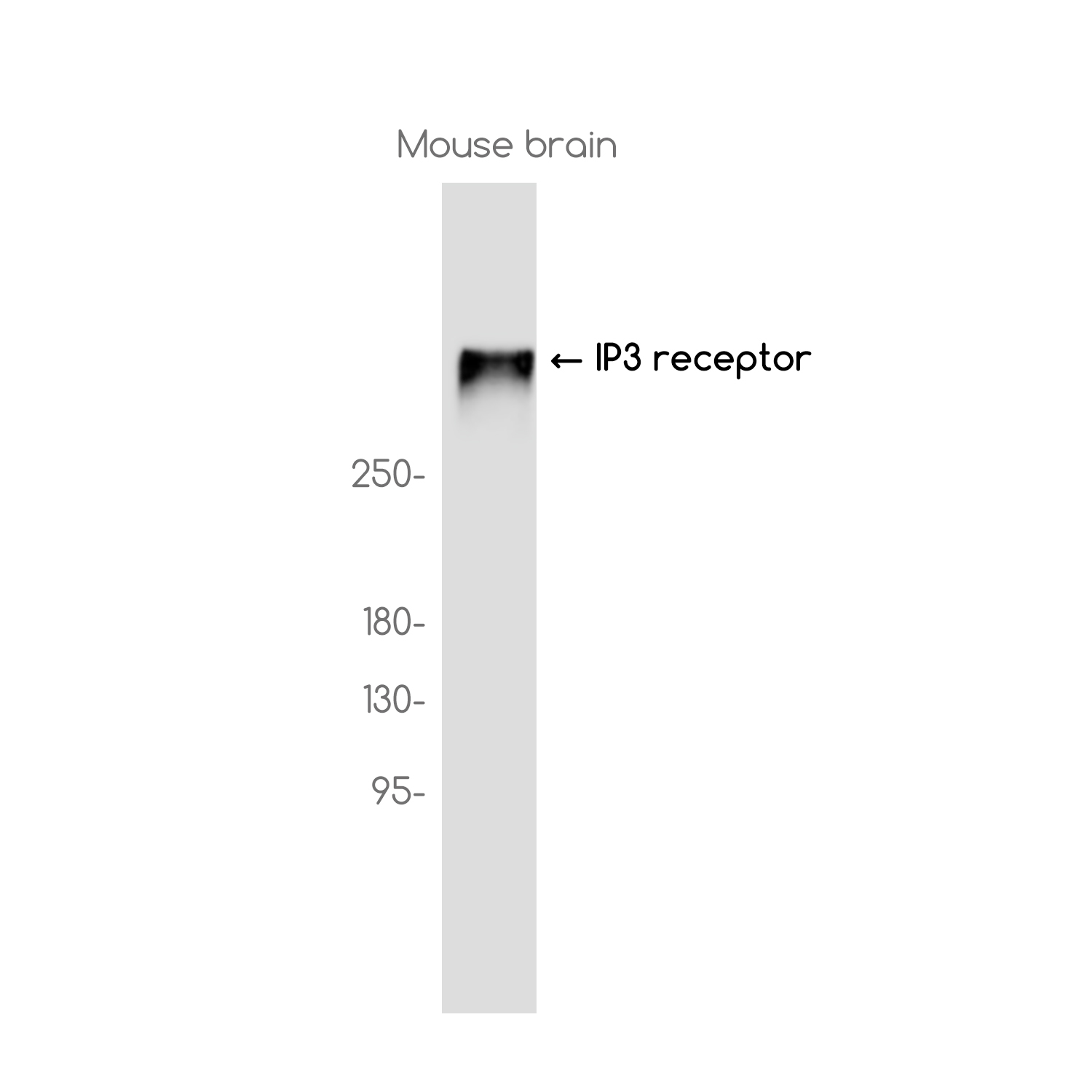 IP3 Receptor Rabbit mAb ABZ3760