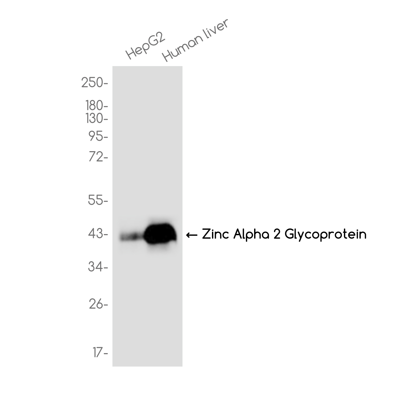Zinc Alpha 2 Glycoprotein Rabbit mAb ABZ3762