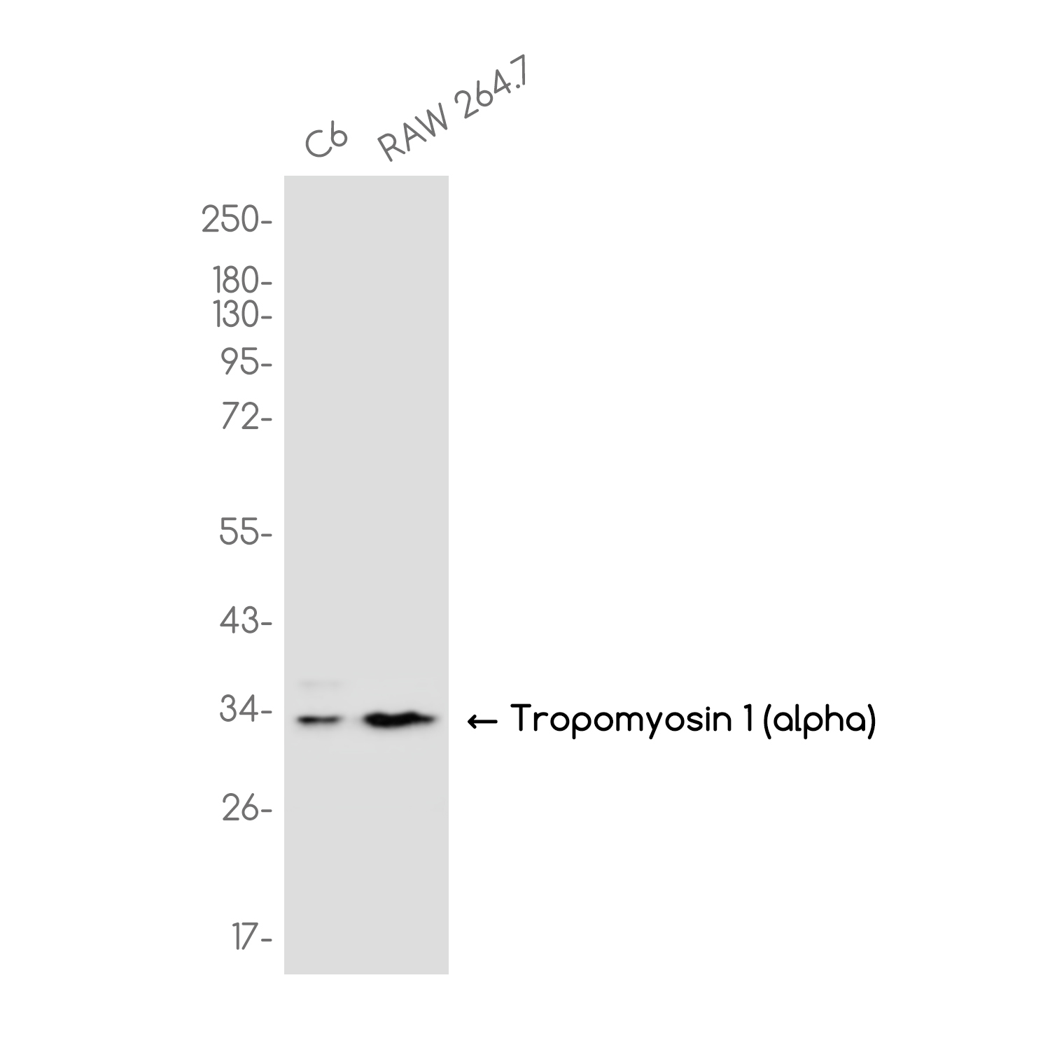 Tropomyosin alpha 1 Chain Rabbit mAb ABZ3764
