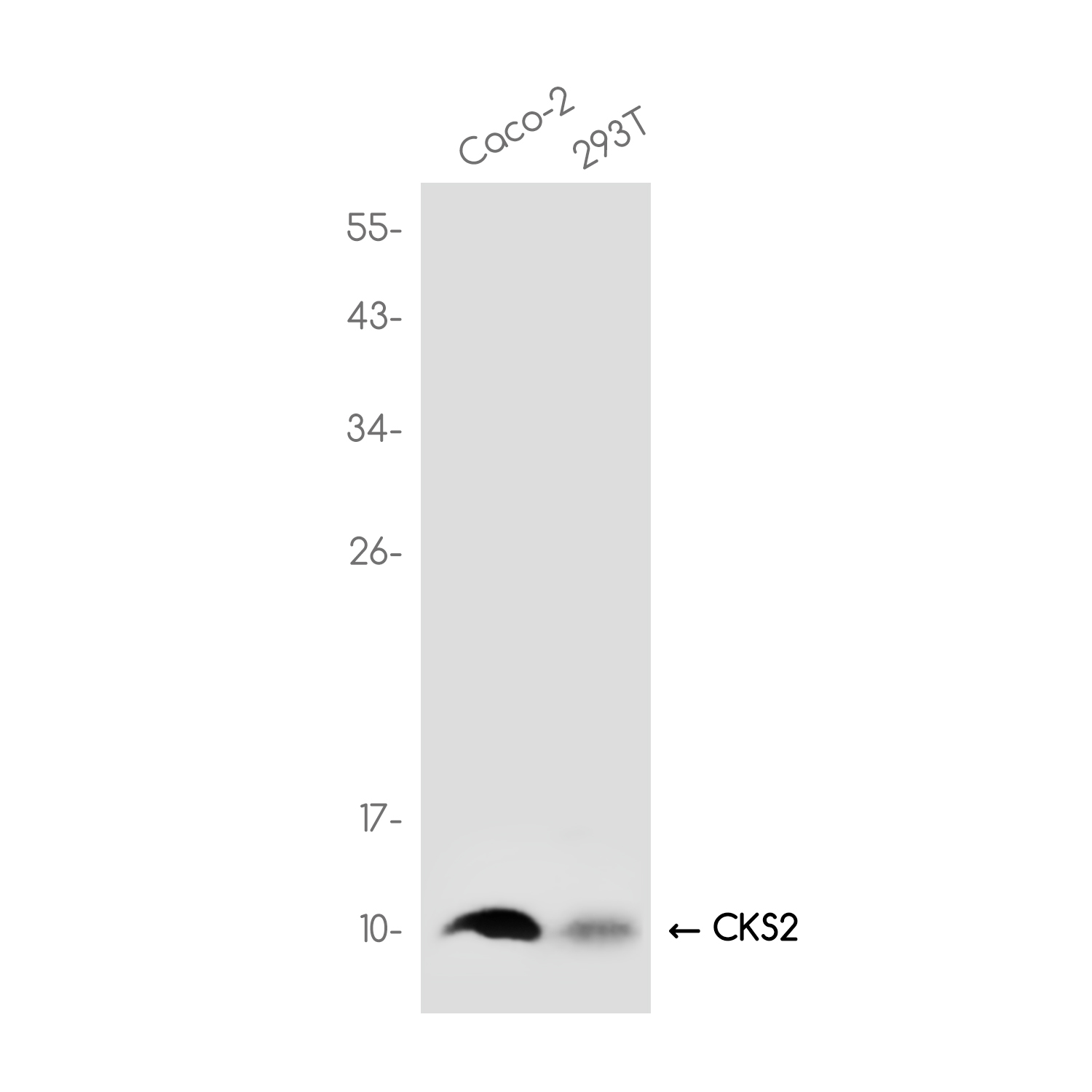 CKS2 Rabbit mAb ABZ3765