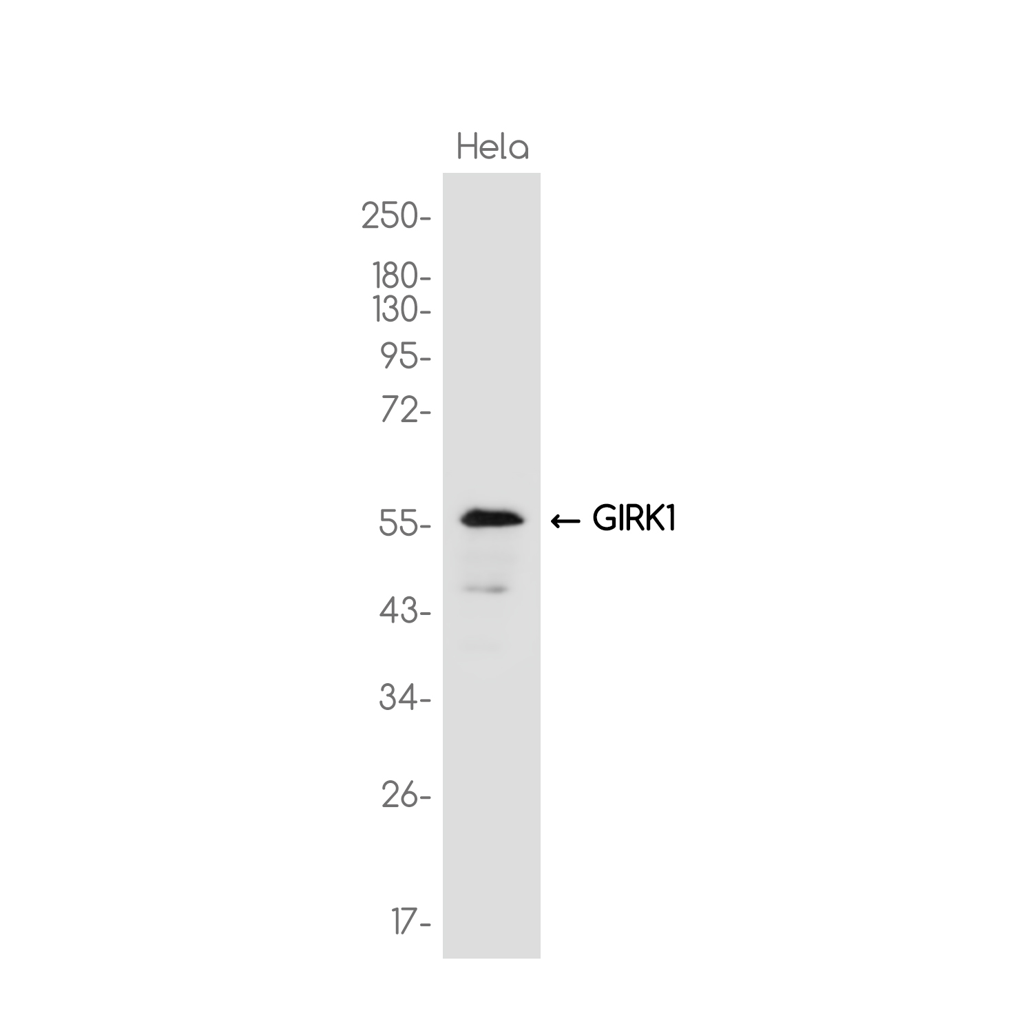 GIRK-1 Rabbit mAb ABZ3766
