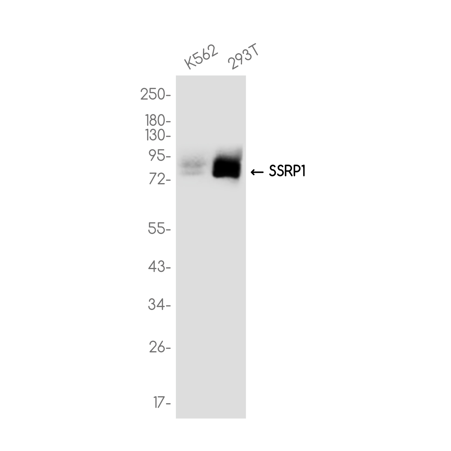 SSRP1 Rabbit mAb ABZ3768