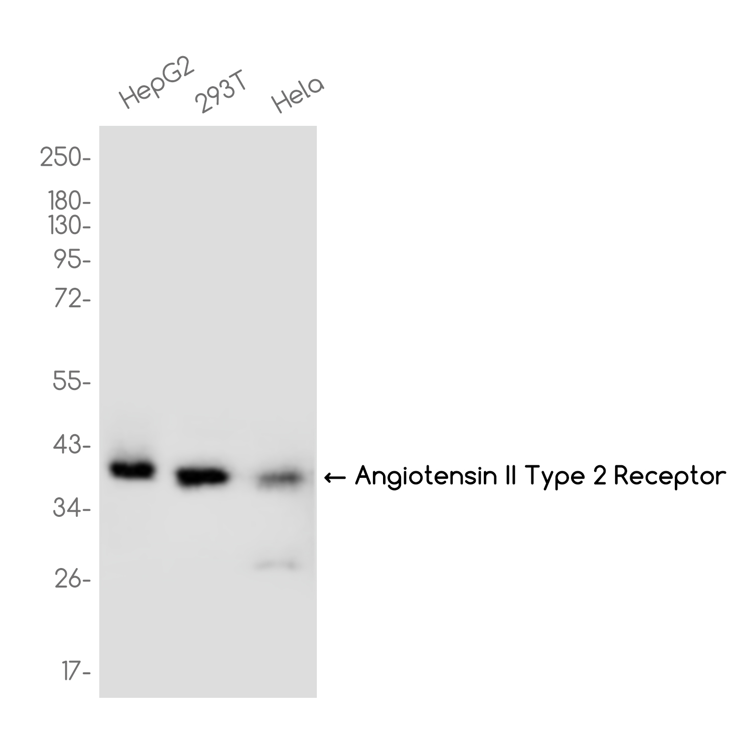 AGTR2 Receptor Rabbit mAb ABZ3769