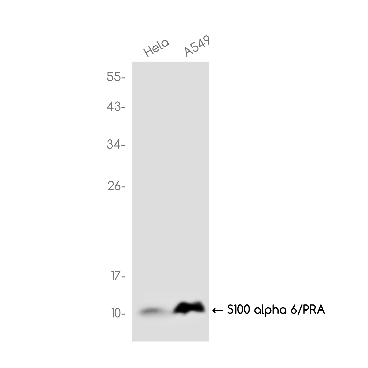 S100 alpha 6 Rabbit mAb ABZ3772