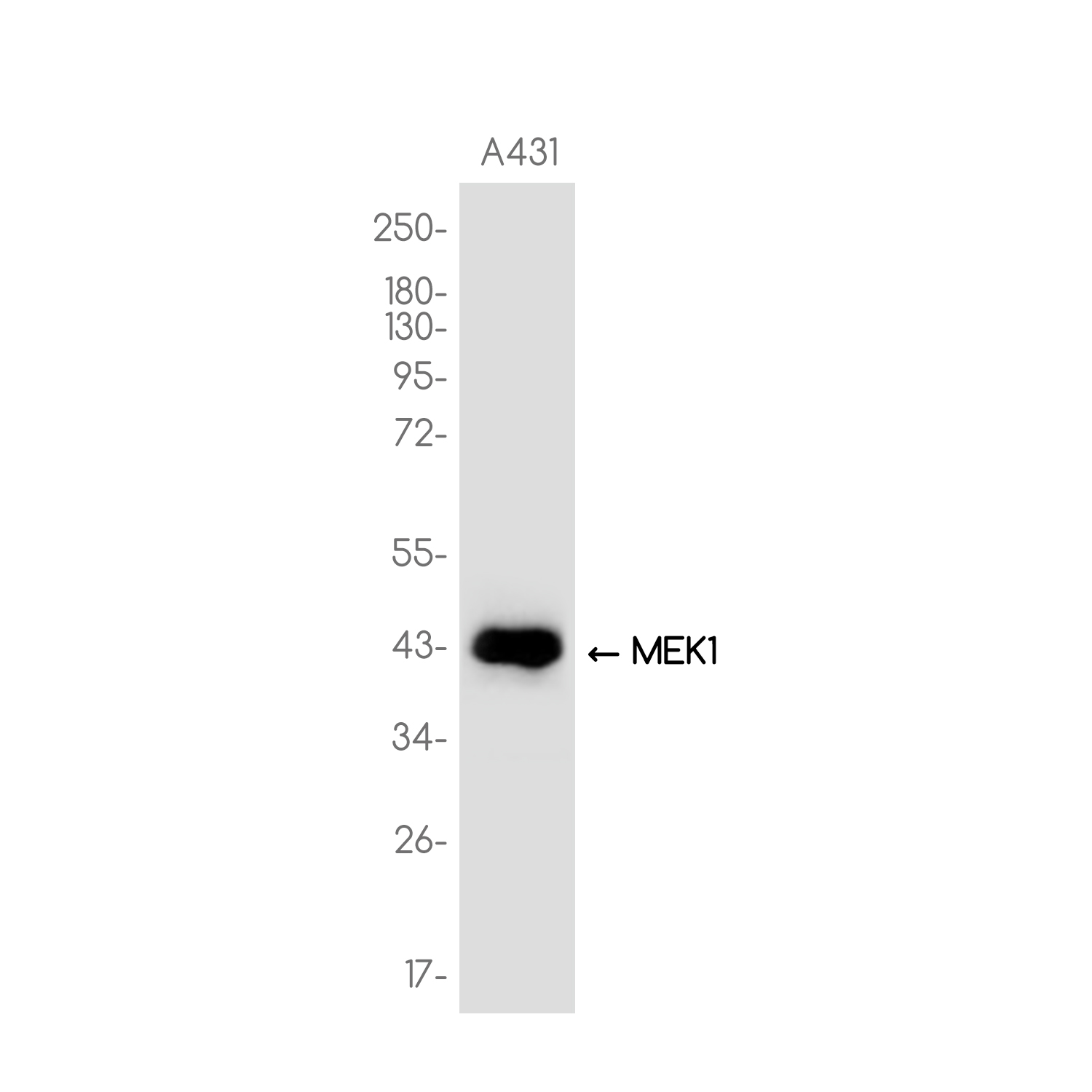 MEK1 Rabbit mAb ABZ3773