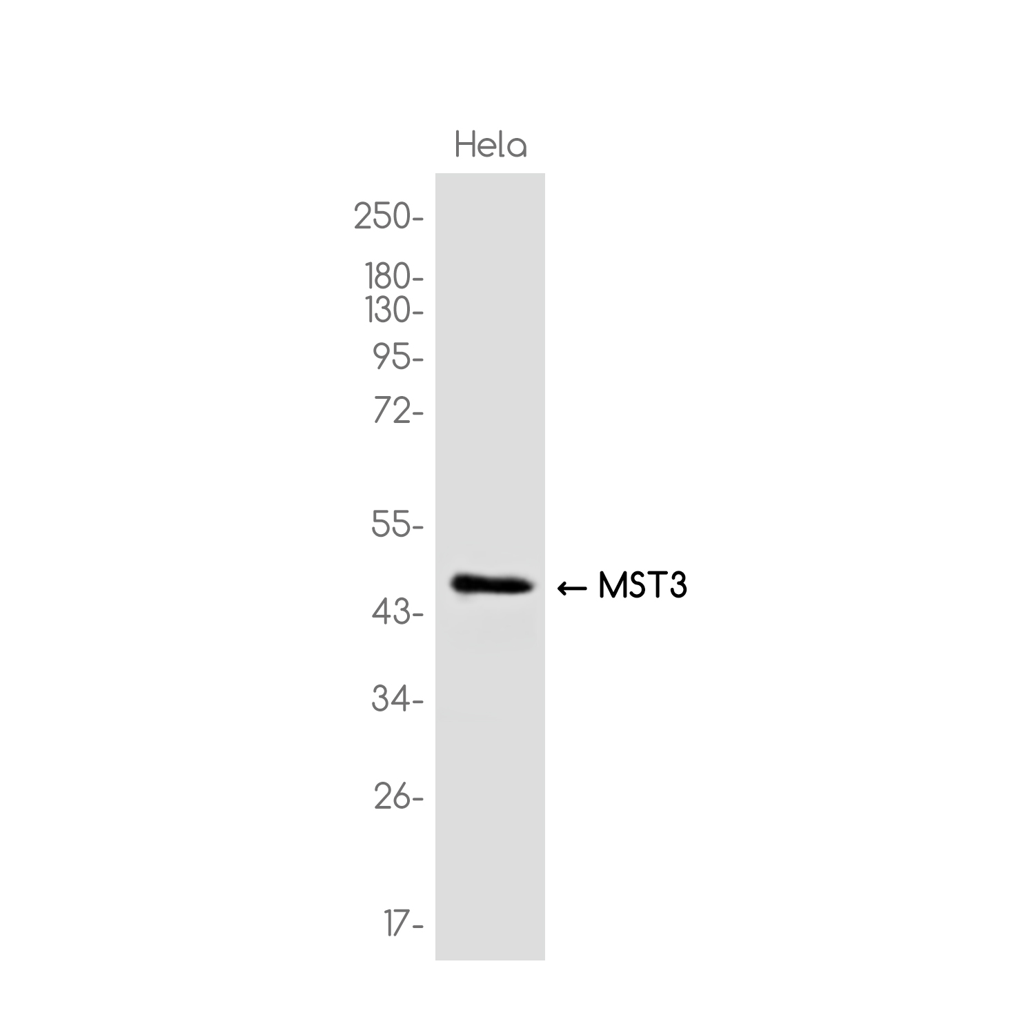 MST3 Rabbit mAb ABZ3774