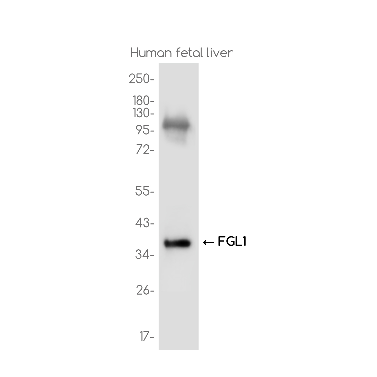 FGL1 Rabbit mAb ABZ3775