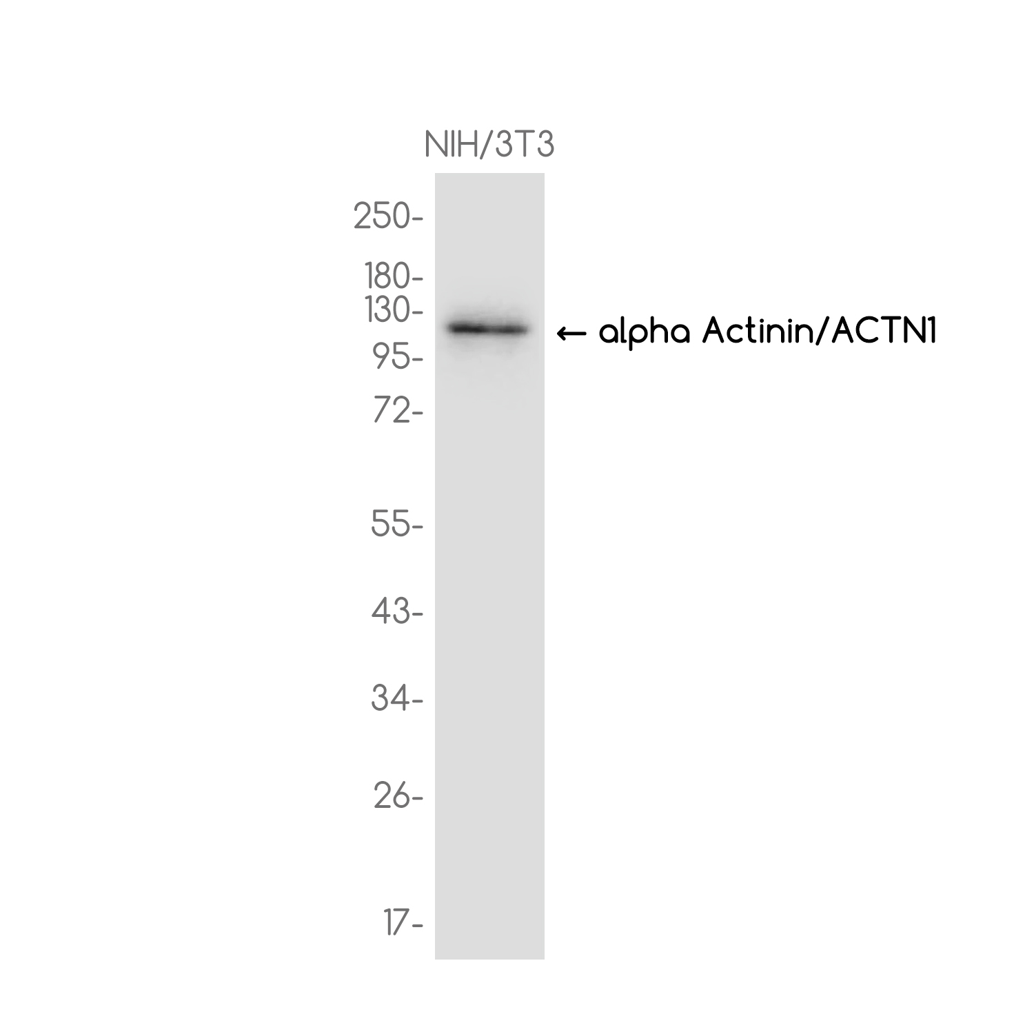 alpha Actinin Rabbit mAb ABZ3776