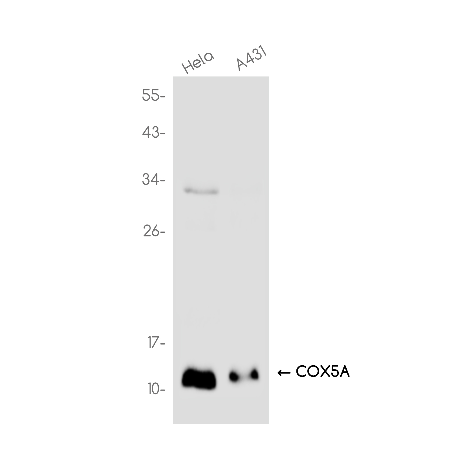 COX5A Rabbit mAb ABZ3778