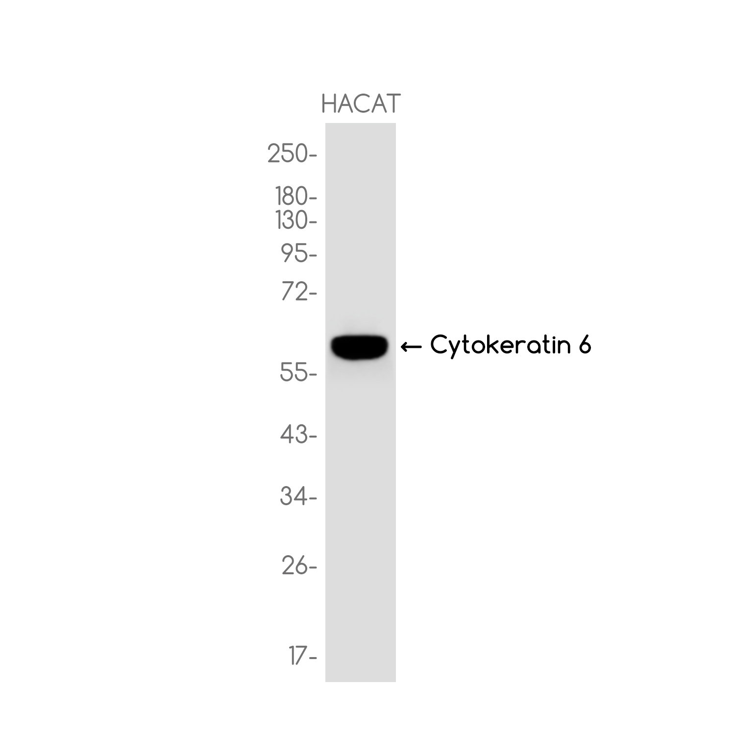 Cytokeratin 6A Rabbit mAb ABZ3780