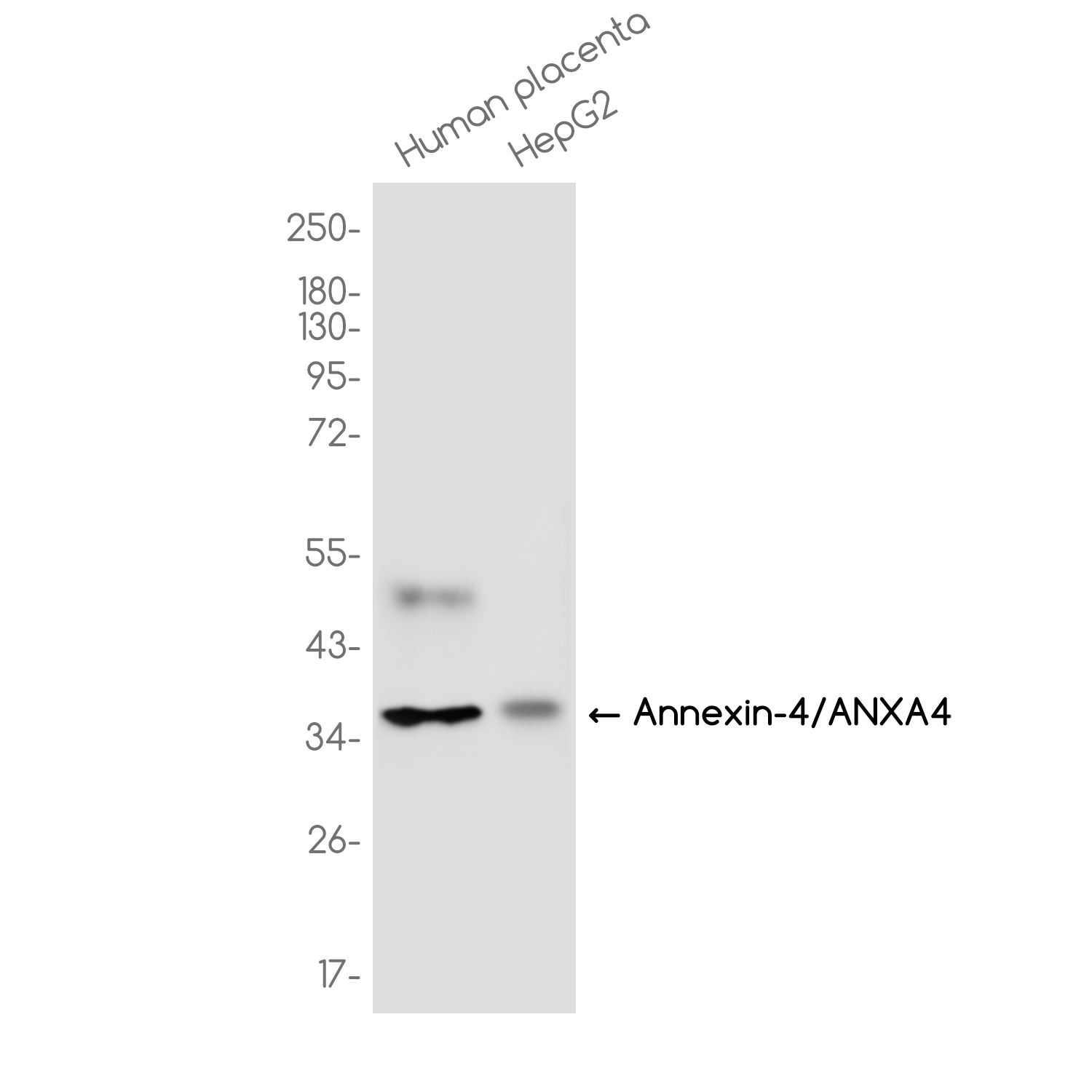 Annexin 4/ANXA4 Rabbit mAb ABZ3783