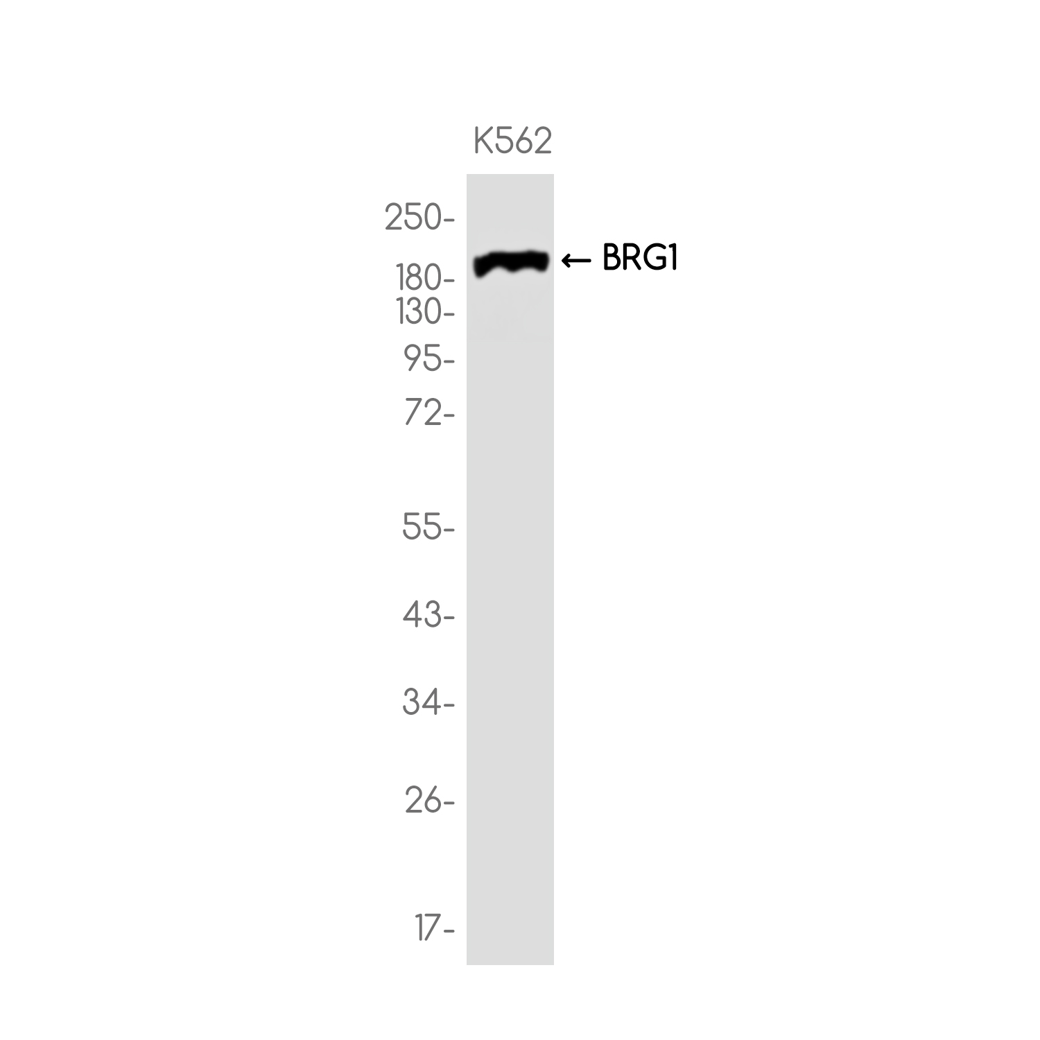 BRG1 Rabbit mAb ABZ3784