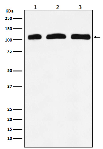 PI3 Kinase p110 delta Rabbit mAb ABZ3793