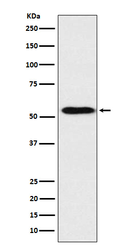 ApoH Rabbit mAb ABZ3794
