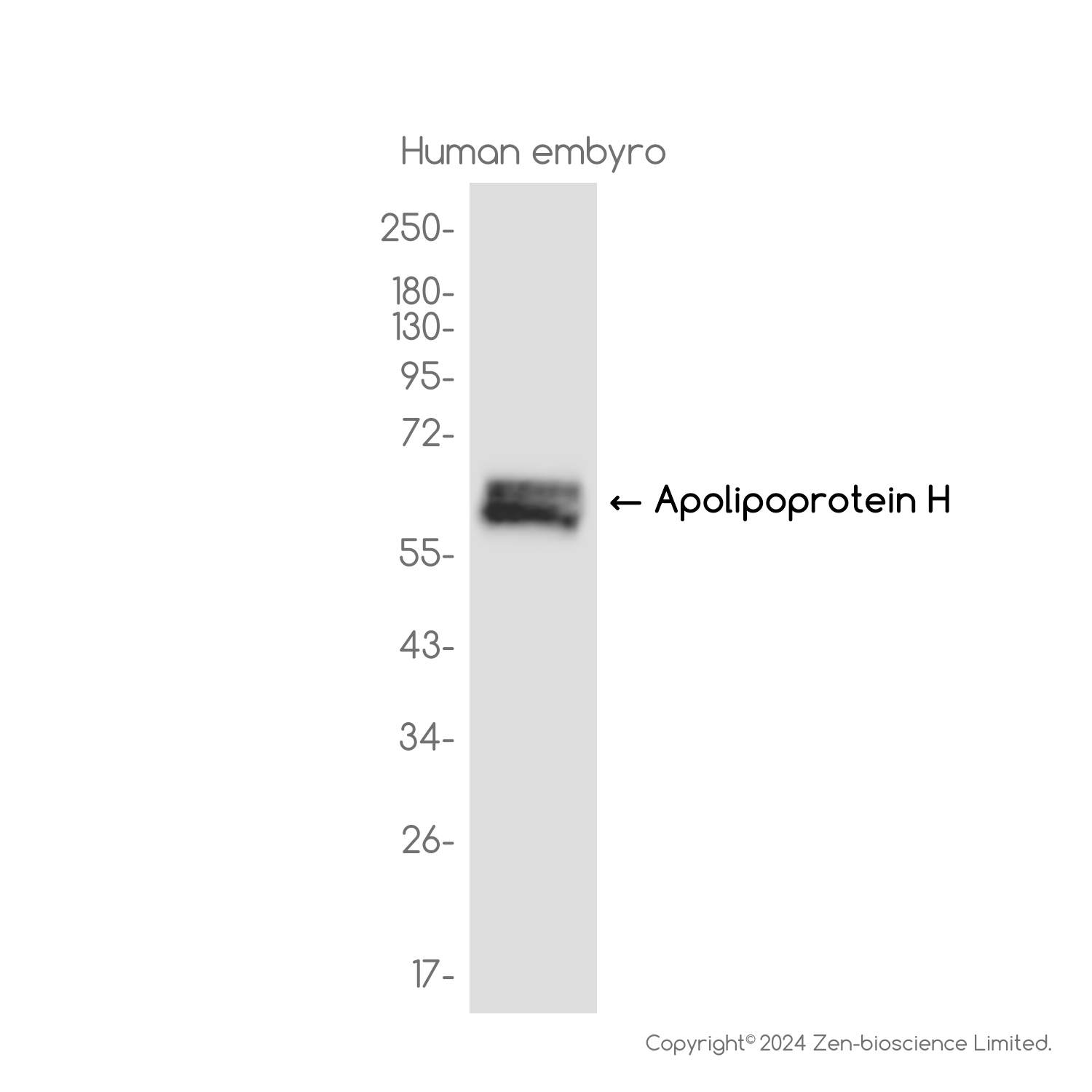 ApoH Rabbit mAb ABZ3794