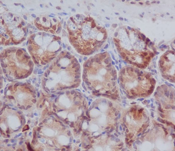 PKC beta 1 Rabbit mAb ABZ3796