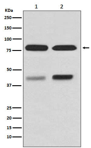 PKC beta 1 Rabbit mAb ABZ3796