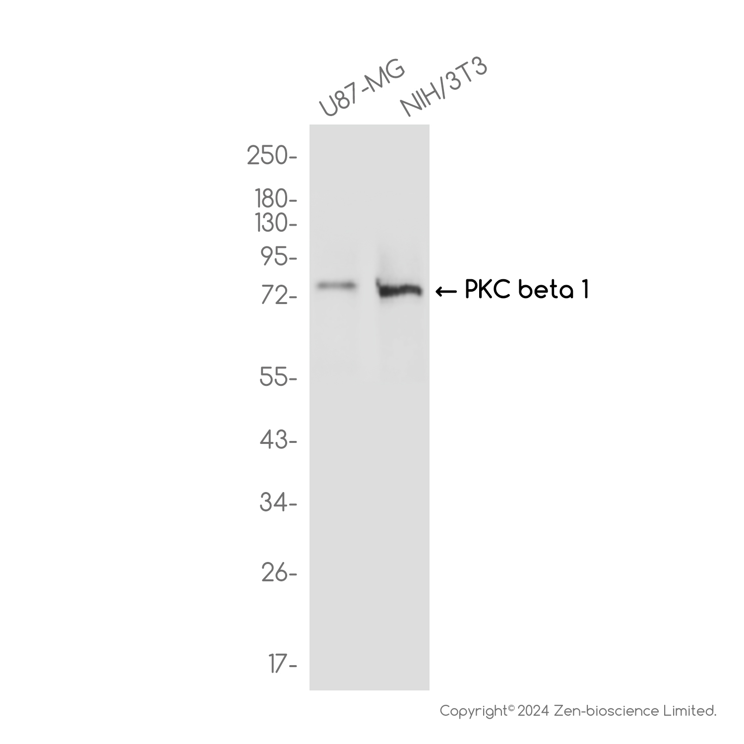 PKC beta 1 Rabbit mAb ABZ3796