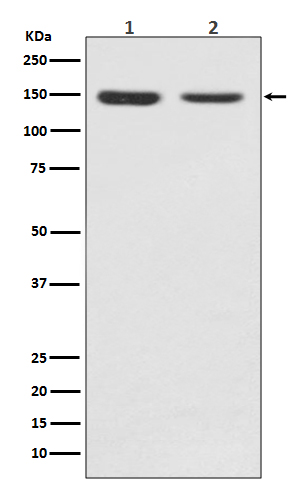 FGFR2 Rabbit mAb ABZ3797