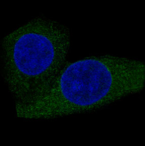 CPT2 Rabbit mAb ABZ3798