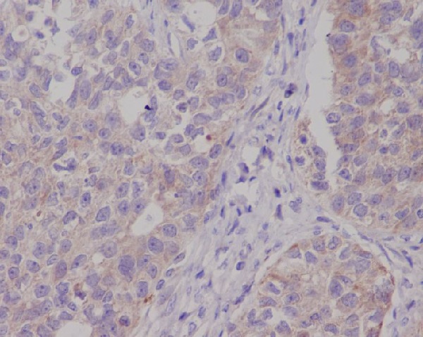 CPT2 Rabbit mAb ABZ3798