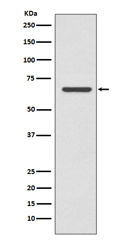 CPT2 Rabbit mAb ABZ3798