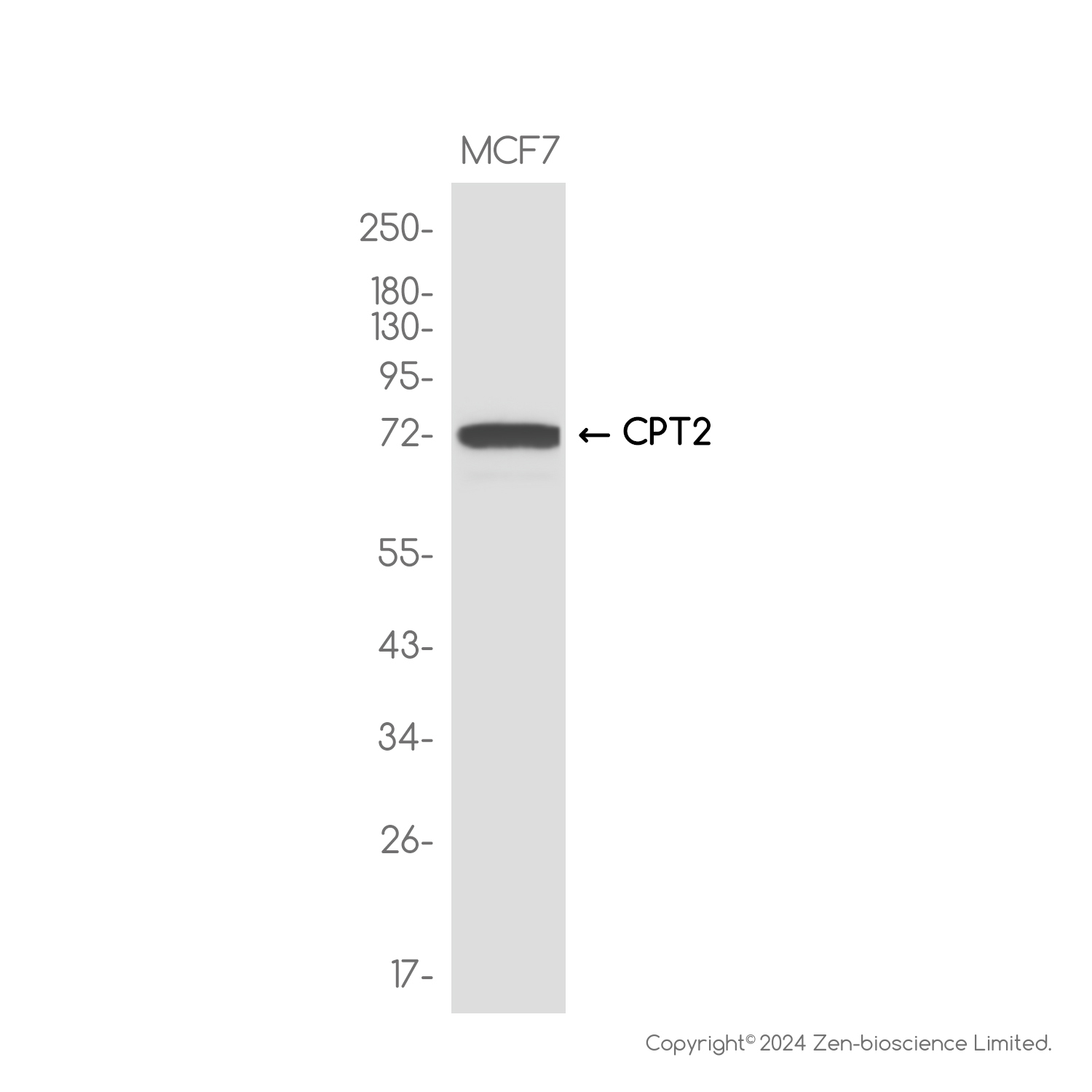 CPT2 Rabbit mAb ABZ3798