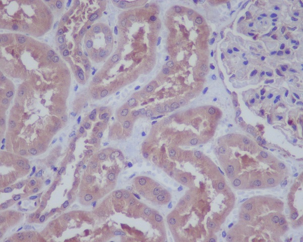 HAPLN1 Rabbit mAb ABZ3799