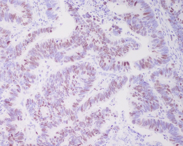 TOP2A Rabbit mAb ABZ3800