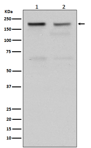 TOP2A Rabbit mAb ABZ3800