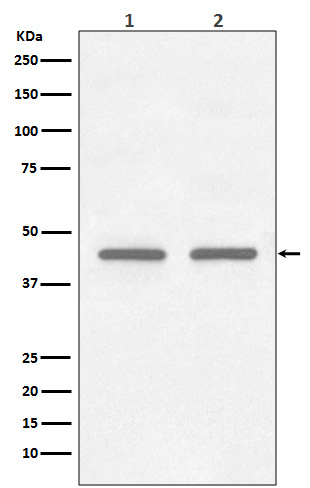 FNTB Rabbit mAb ABZ3802