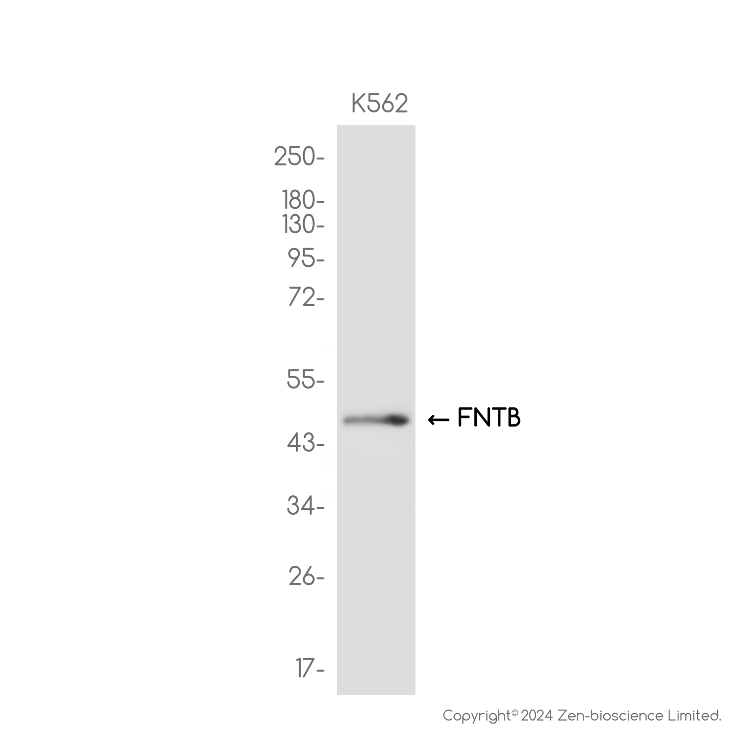 FNTB Rabbit mAb ABZ3802