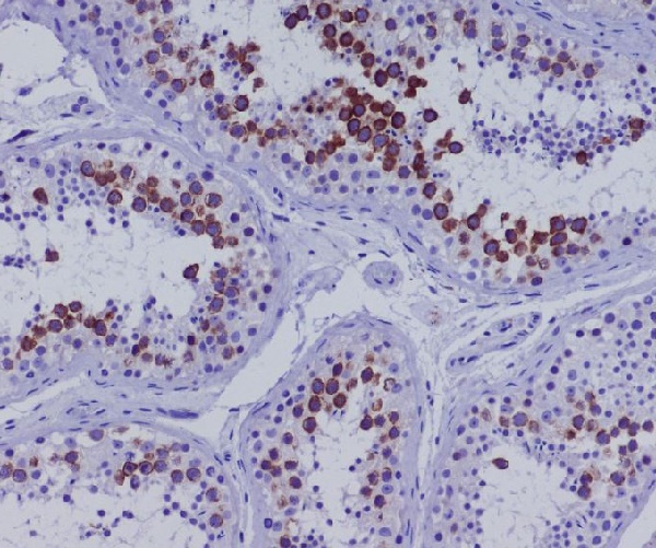 CD168 Rabbit mAb ABZ3803
