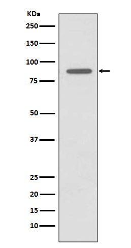 CD168 Rabbit mAb ABZ3803