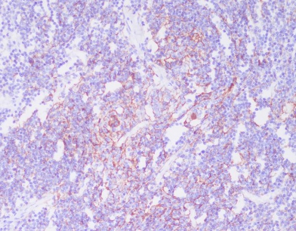 CD21 Rabbit mAb ABZ3804