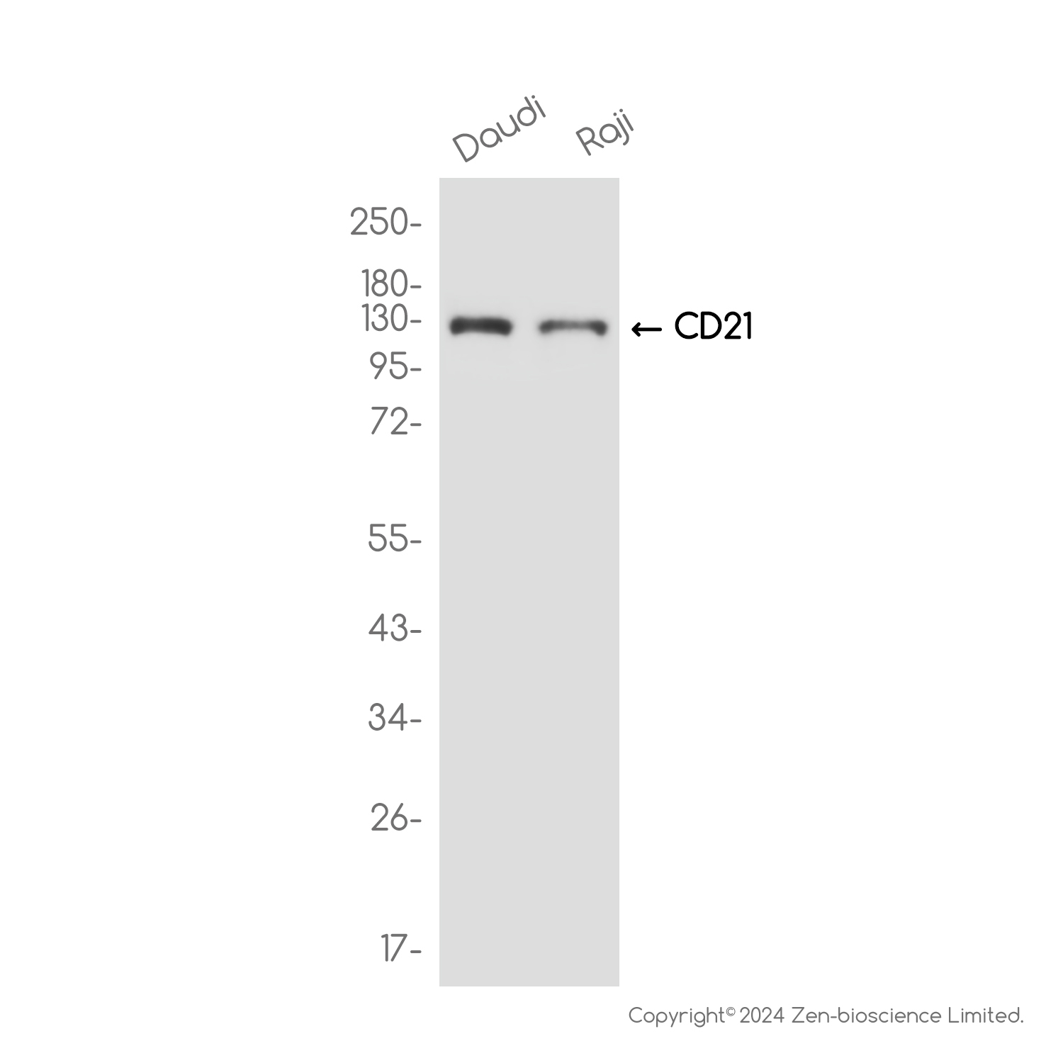 CD21 Rabbit mAb ABZ3804