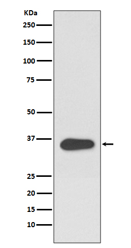 ATF1 Rabbit mAb ABZ3806