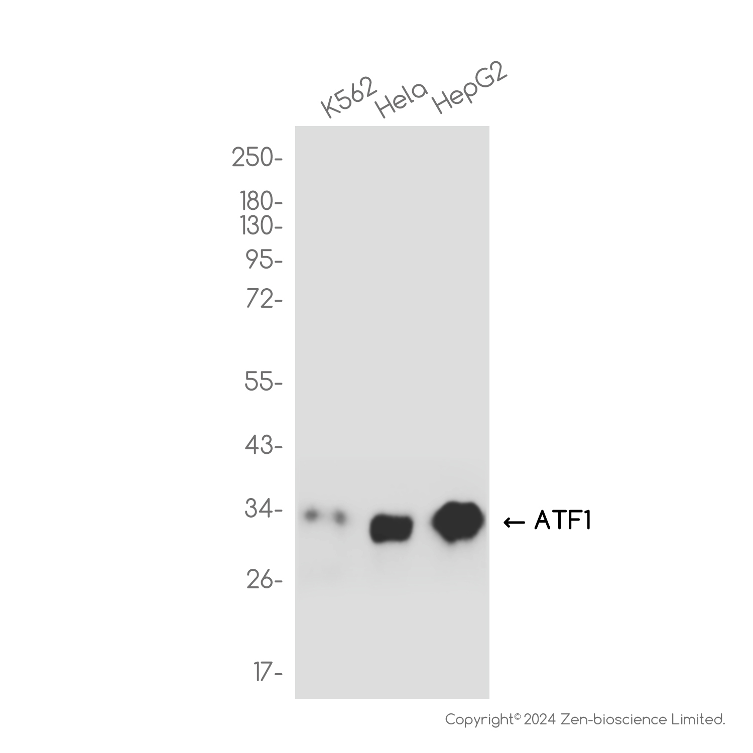 ATF1 Rabbit mAb ABZ3806