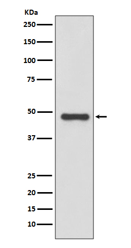 Urokinase Rabbit mAb ABZ3807