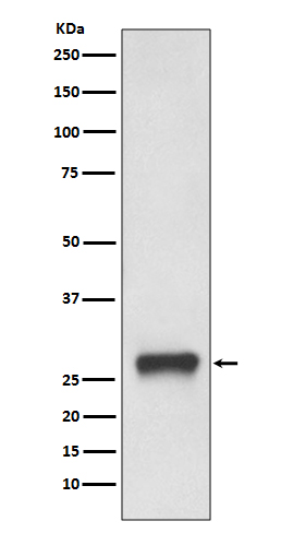 HLA-DPB1 Rabbit mAb ABZ3808