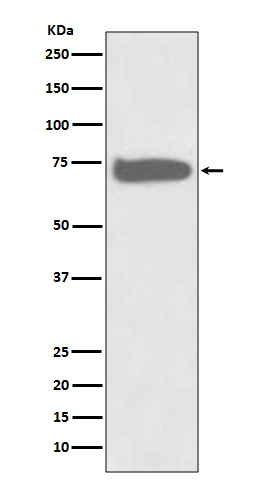 GCLC Rabbit mAb ABZ3809